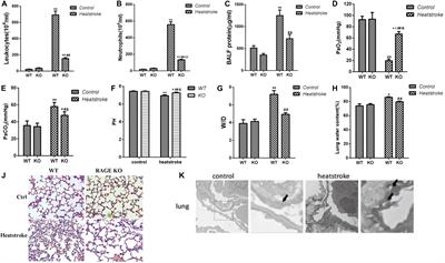 Role of the Receptor for Advanced Glycation End Products in Heat Stress-Induced Endothelial Hyperpermeability in Acute Lung Injury